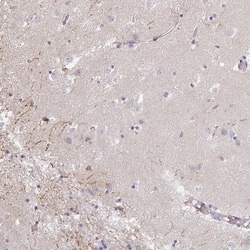 IP6K3 Antibody, Novus Biologicals 25 &mu;L, Unlabeled:Antibodies, Polyclonal